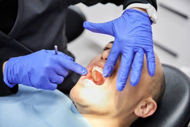 Best Urgent Care for Lost Fillings or Crowns in Half Moon Bay, CA