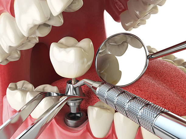 Best Same-Day Emergency Dental Services in Half Moon Bay, CA